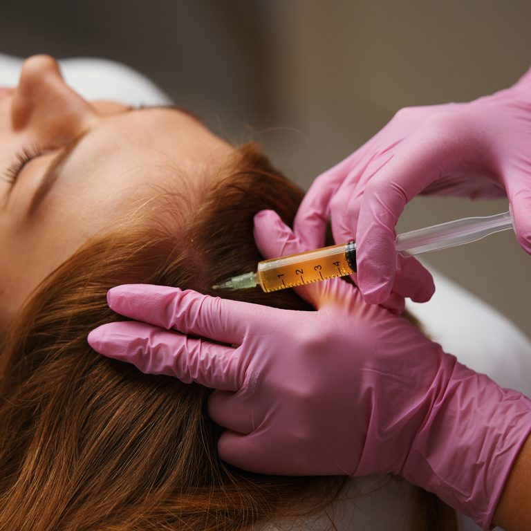 Injections of blood plasma in the face and head. High quality 4k footage